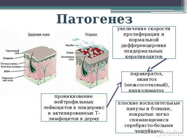 Доброволец в медицинских испытаниях по псориазу