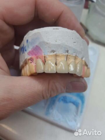 Зубной техник предлагает