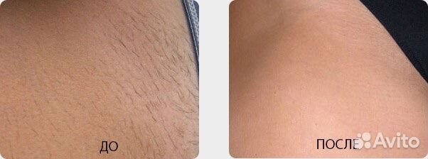 Депиляция (шугаринг, воск, skin’S) Обучение Депиляция (шугаринг, воск, skin’S) Обучение