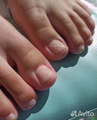 Педикюр/подолог